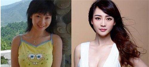 整容可不可以成为人生的赢家？