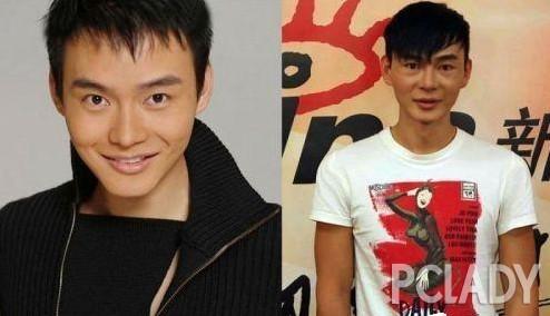 韩彩英整容前后:严屹宽整形视频被曝光，整过容的男星都有哪些？