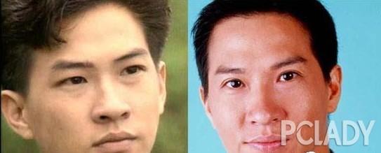 韩彩英整容前后:严屹宽整形视频被曝光，整过容的男星都有哪些？