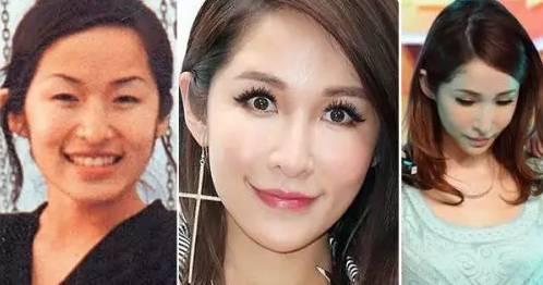 金秀炫承认自己整容:哪些明星承认自己整了容的