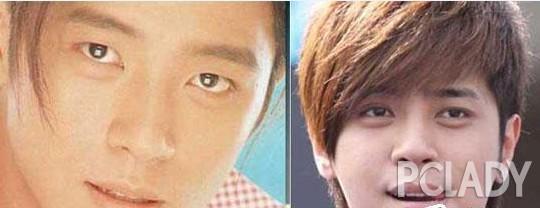 韩彩英整容前后:严屹宽整形视频被曝光，整过容的男星都有哪些？