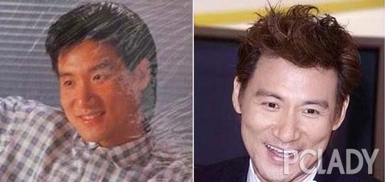 韩彩英整容前后:严屹宽整形视频被曝光，整过容的男星都有哪些？
