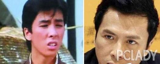 韩彩英整容前后:严屹宽整形视频被曝光，整过容的男星都有哪些？