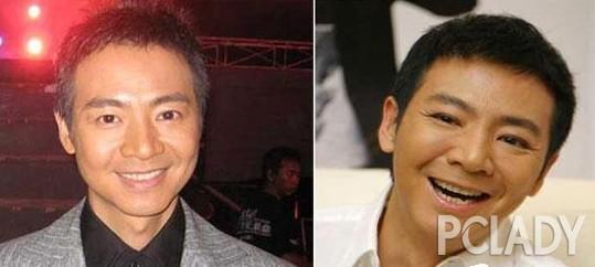 韩彩英整容前后:严屹宽整形视频被曝光，整过容的男星都有哪些？