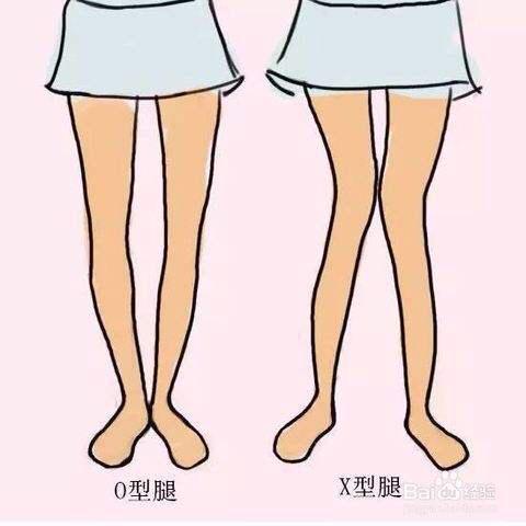 如何练筷子腿:只有小腿粗应该怎么锻炼呢？
