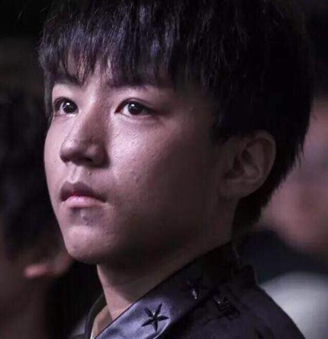 王俊凯整容:王俊凯近照皮肤变黑，满脸爆痘，小男神到底怎么了