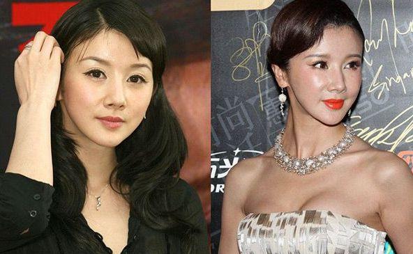李颖芝整容前:整容失败的后遗症有多恐怖？
