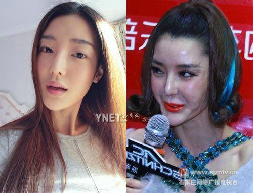 李颖芝整容前:整容失败的后遗症有多恐怖？