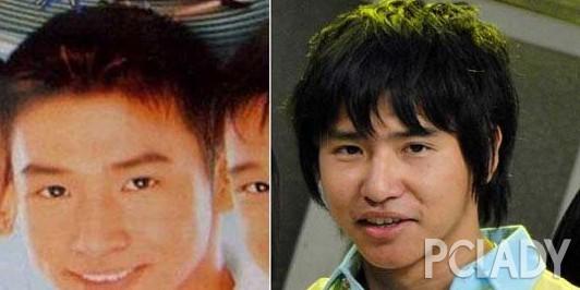 韩彩英整容前后:严屹宽整形视频被曝光，整过容的男星都有哪些？
