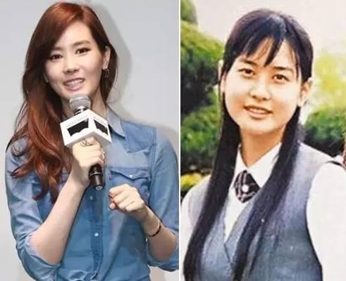 金秀炫承认自己整容:哪些明星承认自己整了容的