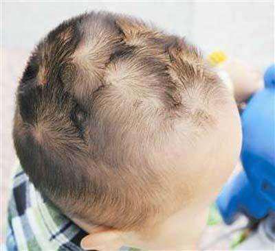 为什么有的孩子头上有2个旋，为什么有的宝宝头上有两个旋？这是不健康的体现吗？