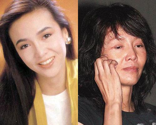 李颖芝整容前:整容失败的后遗症有多恐怖？