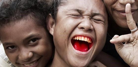 头条问答 男子划伤舌头竟患舌癌 口腔溃疡会癌变成舌癌 当初的美好的回答 0赞