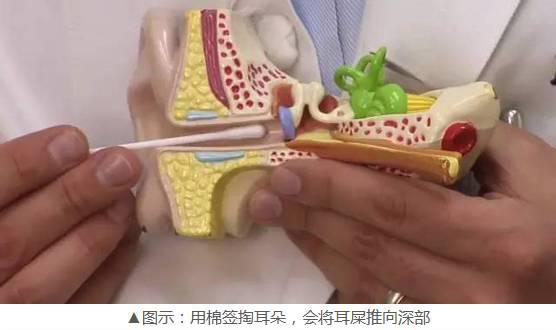 成都何兴丽照片老公是做什么的:成都哪些地方掏耳朵服务最好？
