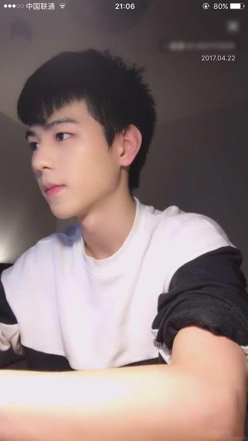杨馥宇整容:你知道那些明星有"缺陷美"