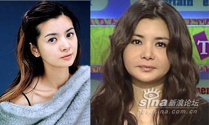 李颖芝整容前:整容失败的后遗症有多恐怖？