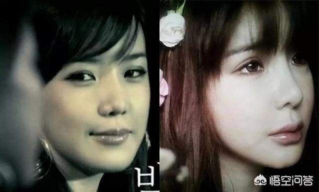 林秀香整容:你对哪部韩剧印象最深？当年最喜欢里面的哪个角色还记得吗？