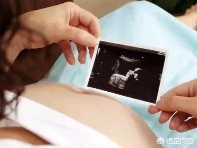 孕中期死胎有什么症状:孕中期死胎是什么原因造成的 孕中期胎停会有什么反应和症状？