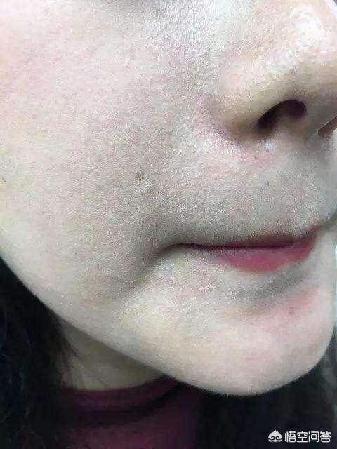 经常卡粉该怎么办？