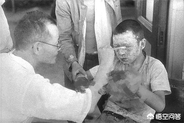切尔诺贝利巨鼠:为何核辐射幸存者不能马上洗头
