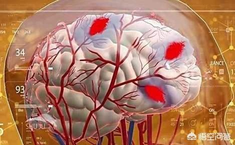 符晓薇:从胃炎到胃癌，仅仅只有4步，应该如何护胃