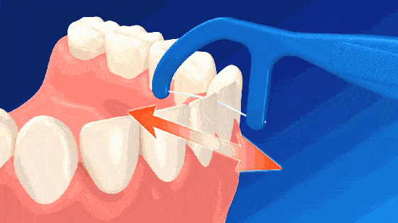 如何爱护牙齿?如何爱护牙齿保护牙齿小学生