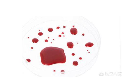 人流手术后注意事项:人流手术后注意事项及调养 流产后的小月子应该怎么坐？