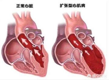 保安遭恶犬攻击 网易:针对网易裁掉身患绝症员工，你有何感想？