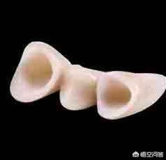 重度四环素牙怎么治:牙齿贴片到底是怎么回事？