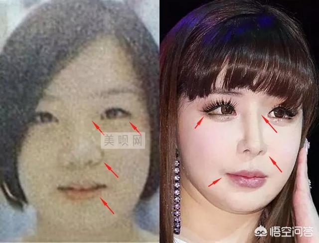 林秀香整容:你对哪部韩剧印象最深？当年最喜欢里面的哪个角色还记得吗？