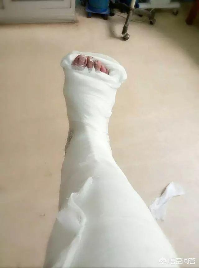 头条问答 - "双脚"出现哪些异常,就要小心糖尿病足了?