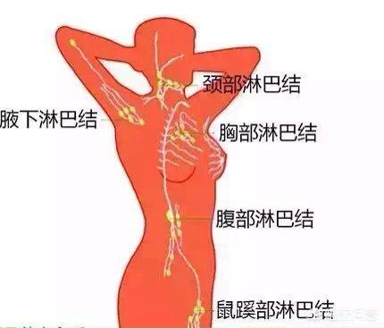 腹部淋巴结位置图图片