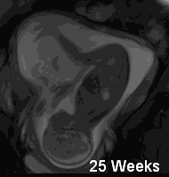 怀孕6个月，孕妇肚子突然一半硬一半软，是胎儿缺氧了吗？该怎么办？插图24