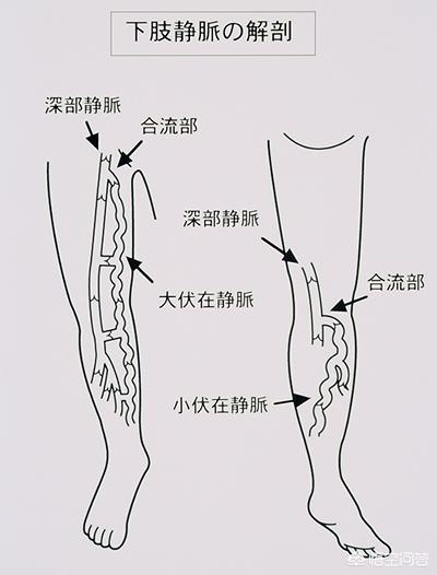 头条问答 腿部浮肿一按一个坑是什么情况 64个回答