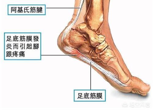 头条问答 脚后跟疼 是什么原因 大妈聊养生的回答 0赞