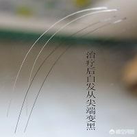 人得了狂犬病潜伏期多久:带有狂犬病毒的狗能活多久？