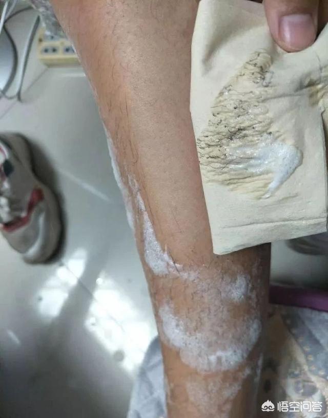 头条问答 女腿毛旺盛说明什么原因 流金岁月有你真好的回答 0赞