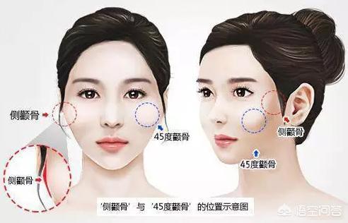 颧骨位置图片,什么样的颧骨比较抗衰老？
