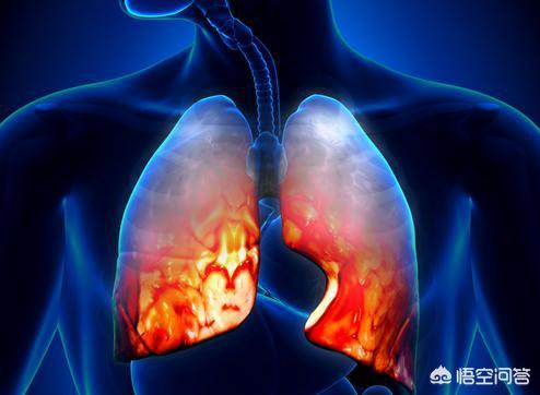 什么是肺纤维化，这个病能康复吗？