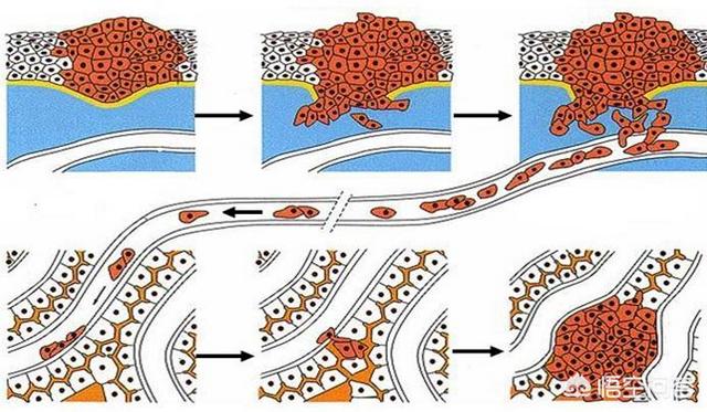 头条问答 - 癌细胞扩散时,身体会释放哪些信号?(32个回答)