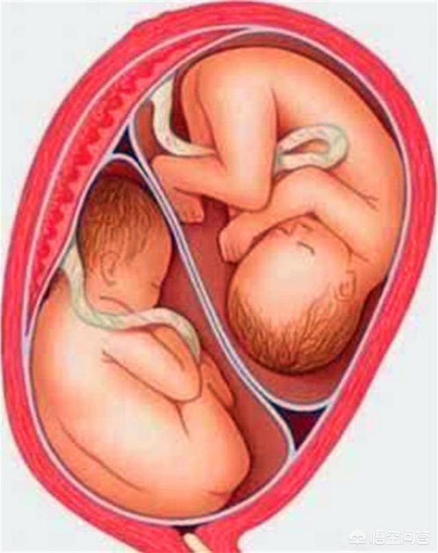 双胞胎胚芽图片