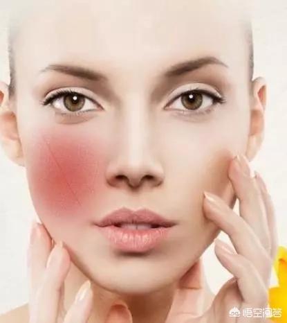 什么样的皮肤适合刷酸，刷酸到底是换脸还是烂脸？