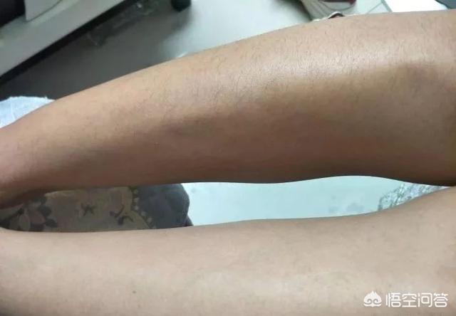 头条问答 女腿毛旺盛说明什么原因 流金岁月有你真好的回答 0赞