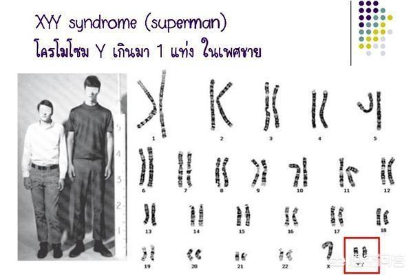 头条问答 男人的染色体是xy 女人是xx 那染色体是yy的人会是什么样子 451个回答