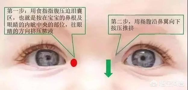 宝宝泪腺炎症状图片:宝宝两个月多了今天见他眼睛里有泪，这是咋回事？