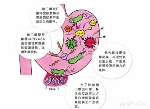得莱姆病症状:得白血病只流鼻血吗，得白血病的症状有什么？ 莱姆病的症状