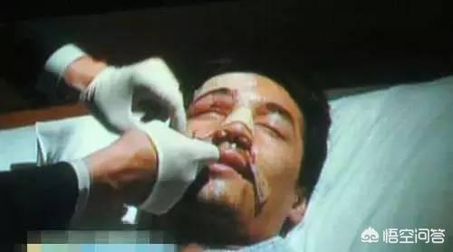 王宝强遇车祸图片:王宝强是怎么发现马蓉出轨的