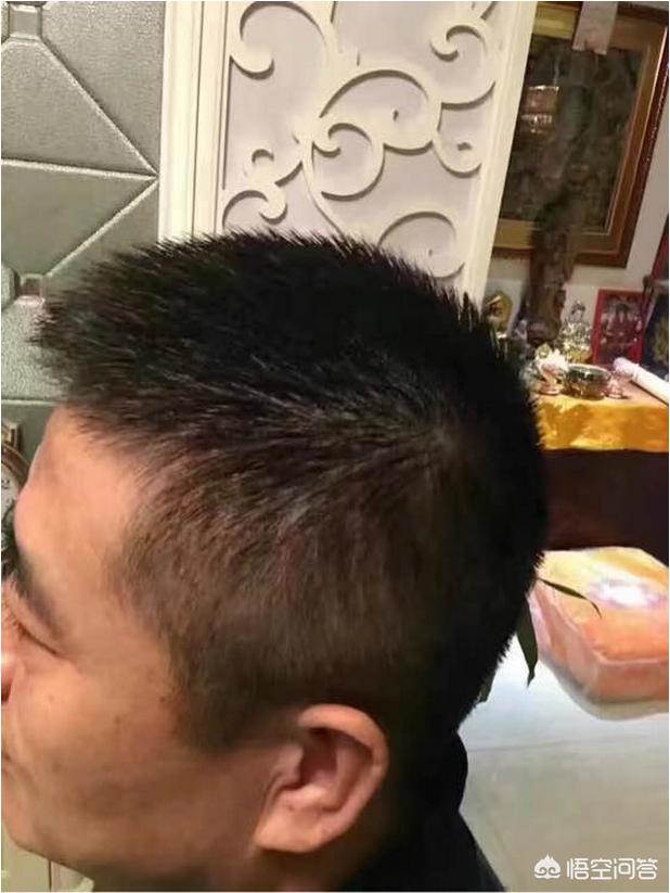 讨论什么方法能让白发转黑发？插图