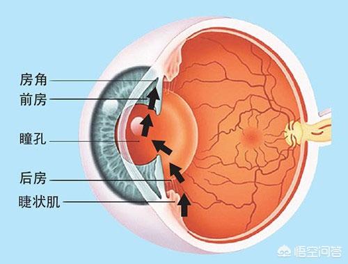 青光眼分类图片