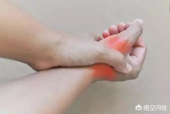 尿酸过高是尿毒症前兆吗:痛风患者，尿酸升高时，是不是肌酐也会跟尿酸一起升高？